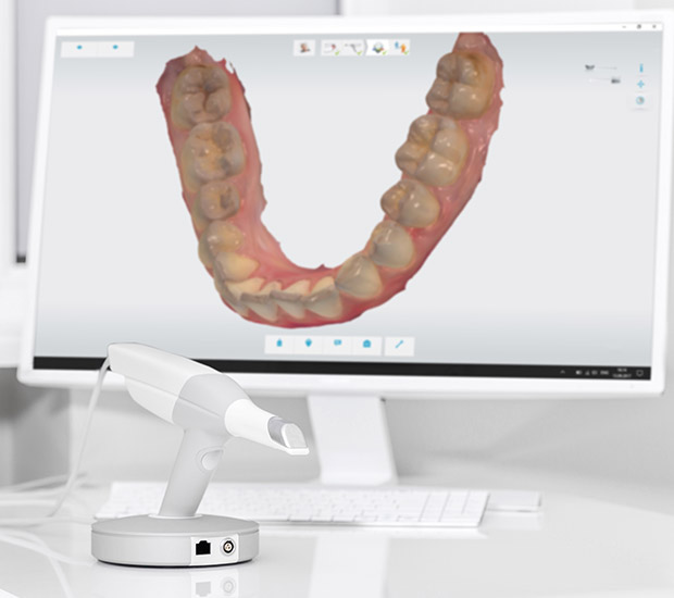 Maricopa 3D Cone Beam and 3D Dental Scans