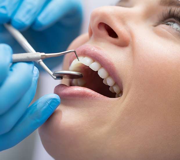 Maricopa Dental Bonding