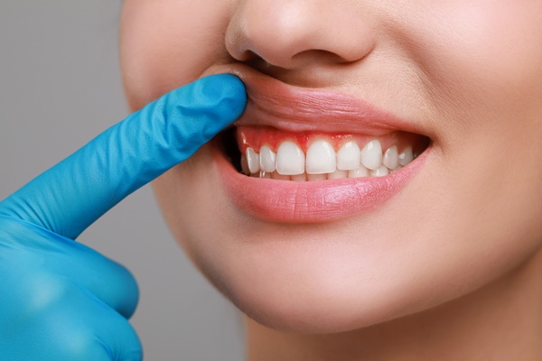 Can You Reverse Gum Disease At Home?