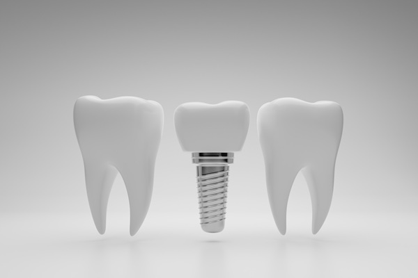 Why You Should Not Fear The Surgery To Get Tooth Implants